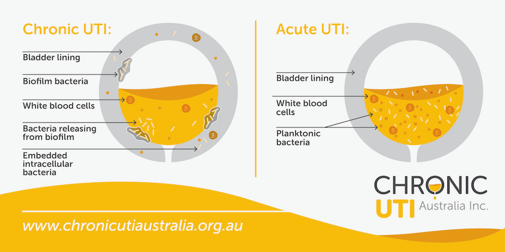 Chronic and Acute UTI differences