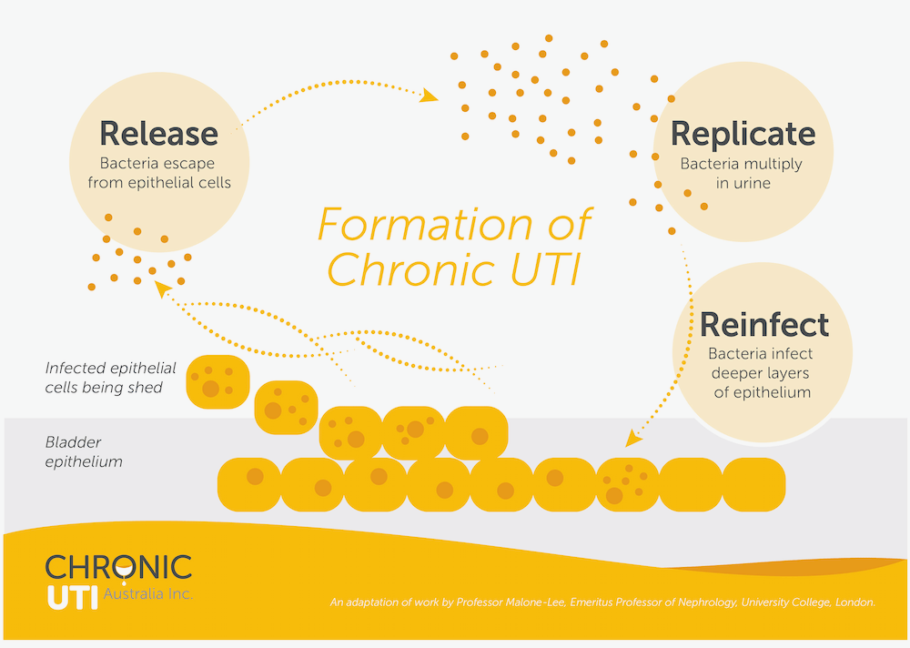 Formation Of ChronicUTI